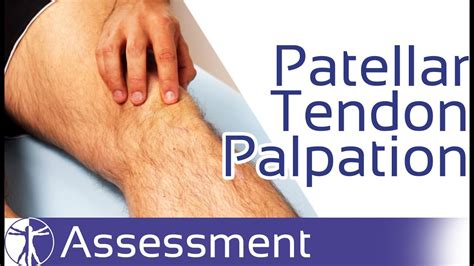 test for patellar tendon tear|patellar tendinopathy diagnosis and treatment.